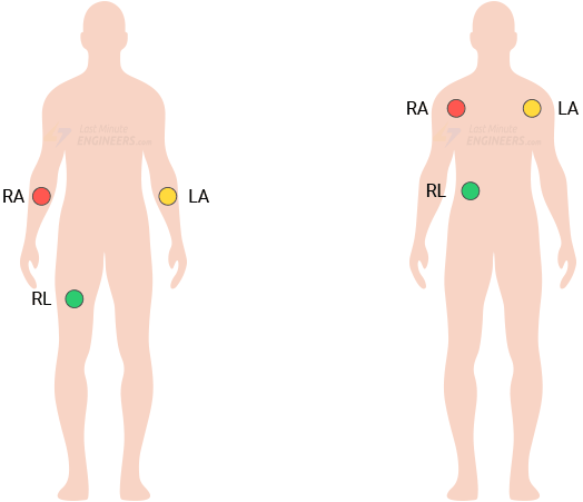 Создание простого ЭКГ-монитора с AD8232 и Arduino