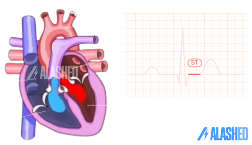 Создание простого ЭКГ-монитора с AD8232 и Arduino